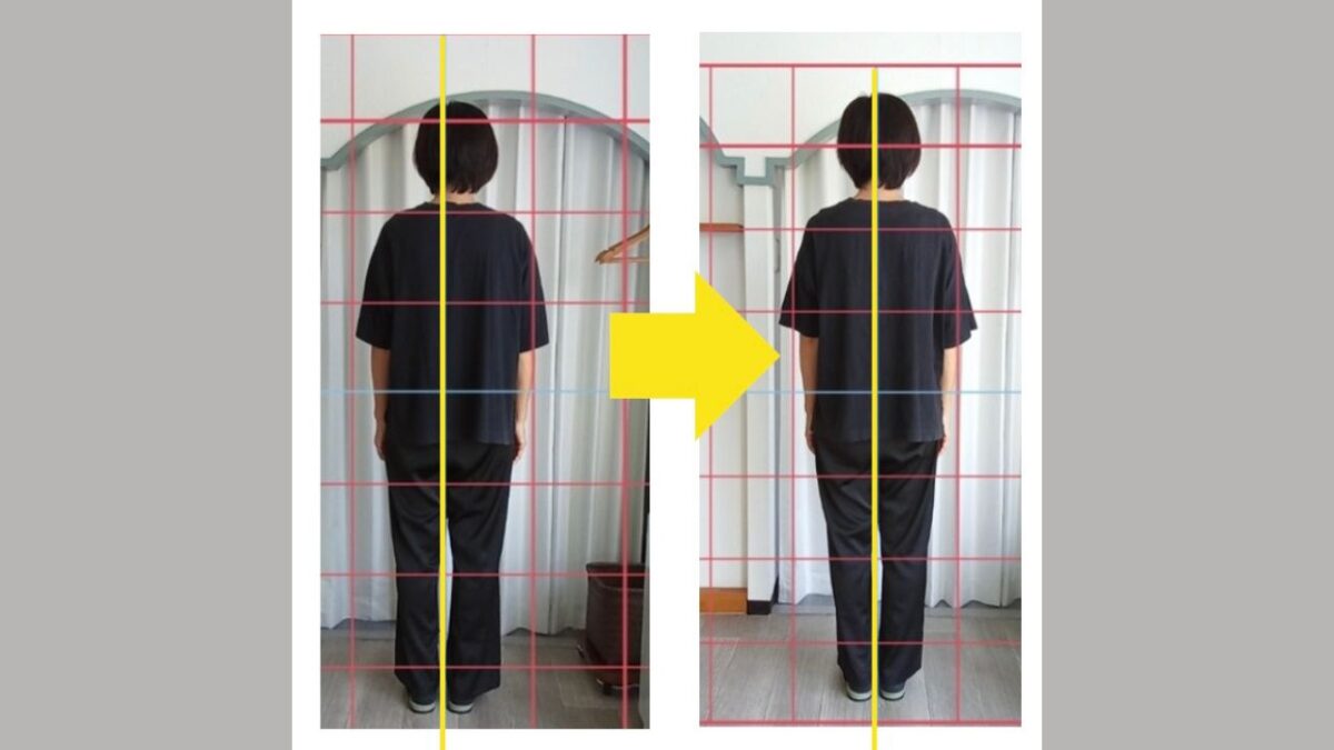 施術前：右肩が下がり、重心が右側へ傾いている
・施術後：肩と骨盤の位置が水平に整い、まっすぐ立てるように